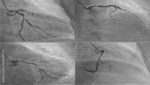 Contrast-Enhanced Visualization of Cardiac Vessel Flow and Structure