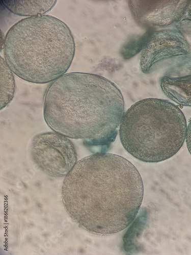 Fotografie Microscopic Morphological Analysis of Tulipa Gesneriana Pollen Grains and Struct