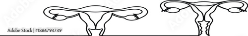 Minimalist Line Art Vector Graphic of Uterus and Ovaries Illustration for Medical Education and Awareness