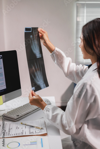 Doctor examining hand bone x ray for diagnosis