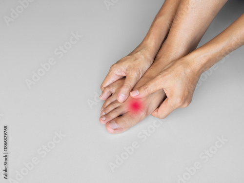 Sore ankle pain foot woman, sprain feet heel knee sore people chronic joint leg hurt injury bone arthritis skeleton girl accident fitness sport exercise medical care treatment massage, osteoarthritis