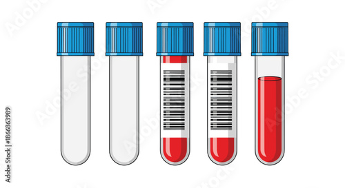 Set of medical test tubes with blue caps for blood analysis, including empty, labeled with barcode, and filled with blood samples.