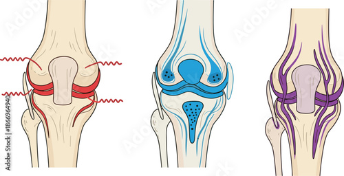 Human knee joint anatomy illustration showing ligaments, cartilage, nerves, medical diagram for education, healthcare, flat vector illustration