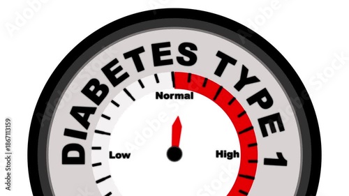 Diabetes Type 1 text or word shown with a barometer or tachometer-style gauge, representing varying levels of blood sugar control and severity of insulin dependency