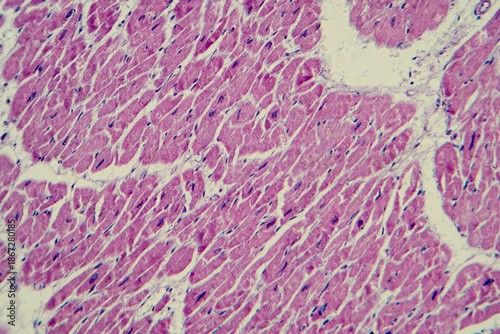 Cardiac hypertrophy, light micrograph