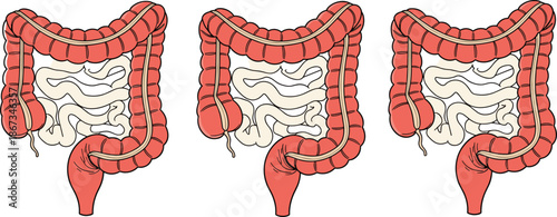 Human large intestine and small intestine anatomy illustration set showing digestive system structure, medical education diagram vector design