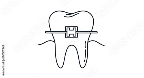 Line drawing of a human tooth with an orthodontic brace wire attached representing dental care and correction.
