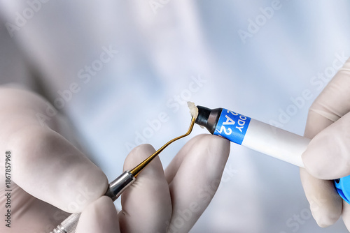 Quadro em tela Close up of dentist hands applying dental composite material using a precision tool