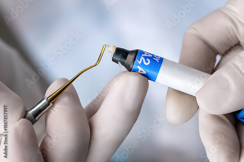Картината върху платно Close up of dentist hands applying dental composite material using a precision tool