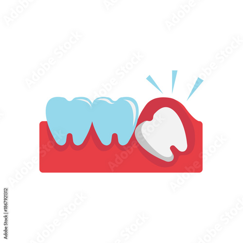 Cartoon Illustration of Tooth Being Pulled from Gum.