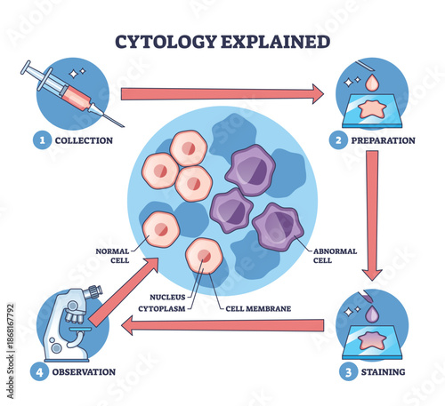 Cytology explained workflow visualizes cell analysis steps collection, preparation, staining, observation with cells, microscope, and syringe guiding diagnosis. Outline diagram