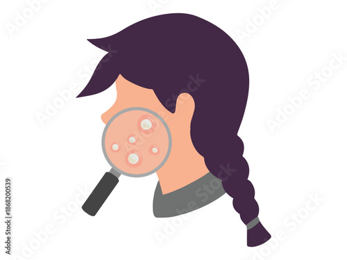 Acne Whitehead in Face Skin Illustration
