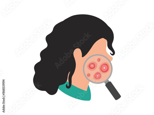 Acne Cystic in Face Skin Clip Art
