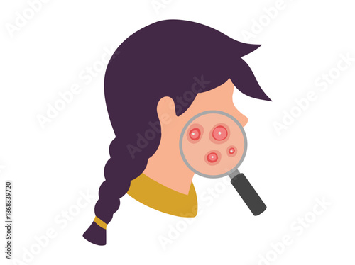 Hand Drawn Acne Cystic in Face Skin
