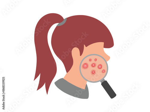 Acne Cystic in Face Skin Illustration
