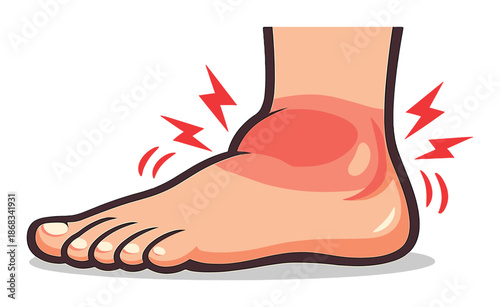 Cartoon illustration of a painful swollen ankle with red highlights