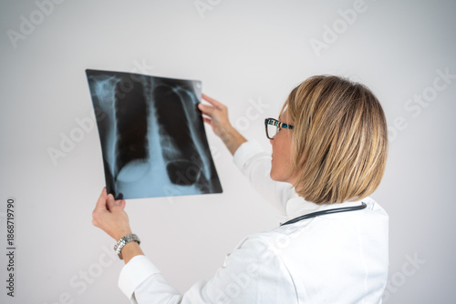 Female doctor examining a lung radiography
