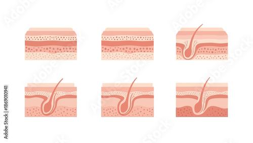 Diagram of Skin Layers and Hair Follicle A Comprehensive Illustrated Guide
