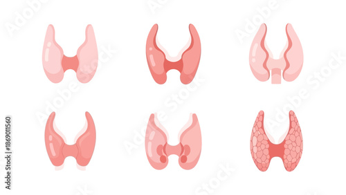 Various Illustrations of the Human Thyroid Gland in Different Forms
