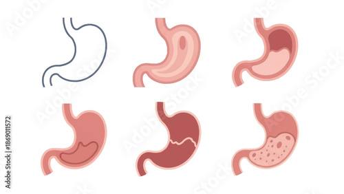 Illustrative stages of the human stomach, highlighting its function and conditions