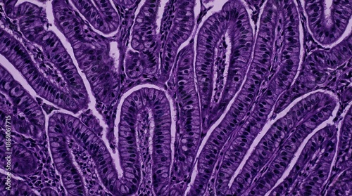 Microscopic view of glandular tissue with complex folded structures, stained purple for histological examination.