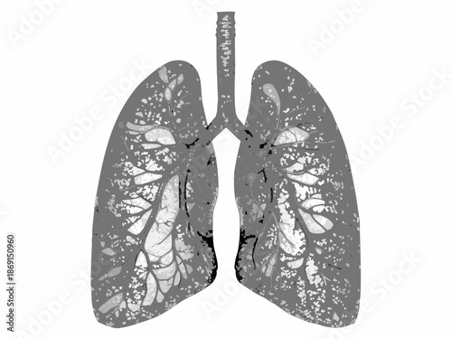 Detailed illustration of human lungs showing branching airways and alveolar structure