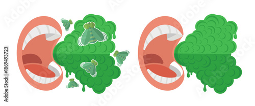 Person Breathing Bad Breath From Mouth. Open Mouth With Cloud of Green Unpleasant Odor. Vector illustration In Flat Style Isolated On White. 