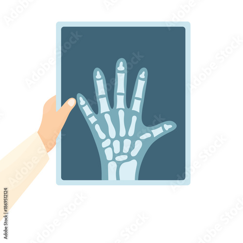 A doctor's hand in a white coat holds an X-ray of a hand against a white background. Concept for diagnosing bone problems and fractures. Elements of medicine