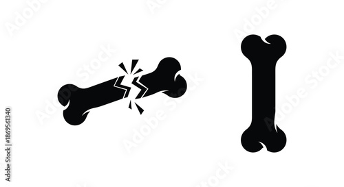 Broken bone and whole bone graphic depiction in dark silhouette