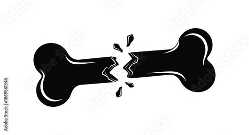 A broken bone graphic depicted in a stark black silhouette