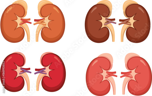 Human kidney anatomy illustration set showing healthy and diseased kidneys medical organ diagram flat vector isolated on white background