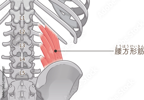 腰方形筋のイラスト、quadratus lumborum illustration