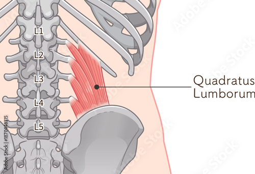 腰方形筋のイラスト、quadratus lumborum illustration