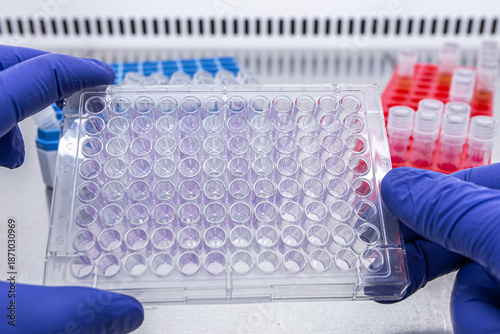 Cuadro en lienzo An immunological tablet in the hands of a doctor in a laboratory against the background of racks with test tubes