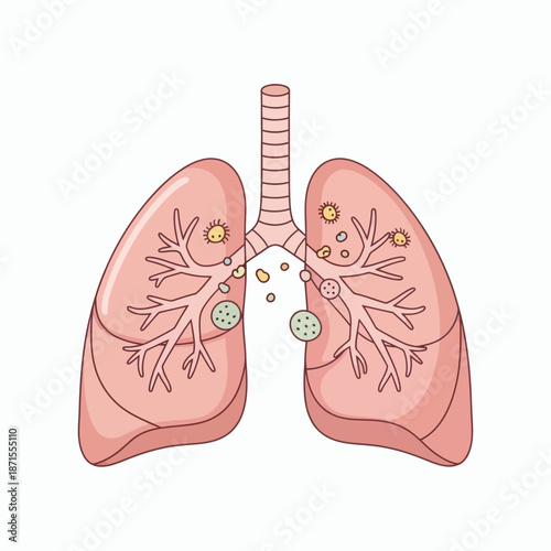 Human Lungs with Disease and Infection Illustration.
