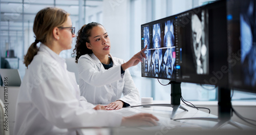 Photos Female Radiologist Examining Spine MRI On Computer Screen