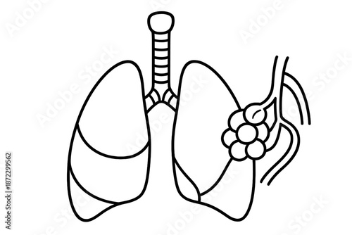 Diagram showing human lungs and bronchial structure with alveoli labeled for educational purposes