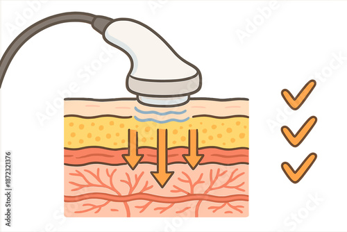 Ultrasound device demonstrating skin treatment layers in a healthcare setting