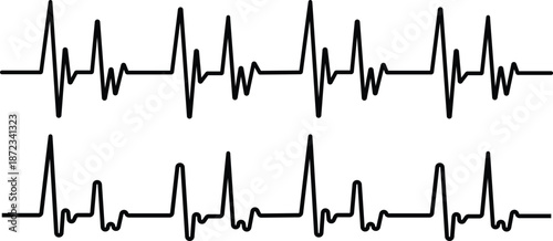 Electrocardiogram display showing heart rhythm patterns and cardiac activity readings