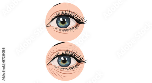 Comparison showing a young smooth eye versus an aging eye with prominent wrinkles, crow's feet, and skin texture.