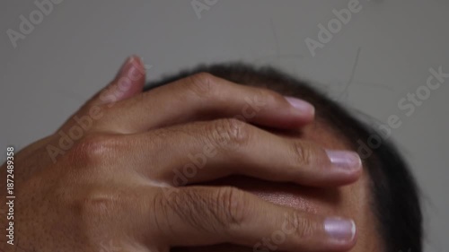 薄毛の頭を撫でる男性の頭（日本人、30代）