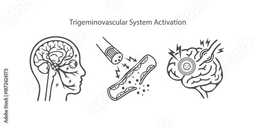 Trigeminovascular System Activation Icon Set. Vector Line Art of Migraine Mechanism, Trigeminal Nerve, and Brain Pain.