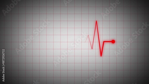 Red cardiogram waveform with glowing dot on gray grid background. Medical monitoring visual for healthcare technology, cardiology displays, clinical dashboards, and digital signal animation.