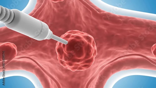Medical probe targeting a tumor or abnormal growth within a biological tissue network, illustrating a precise therapeutic or diagnostic intervention.