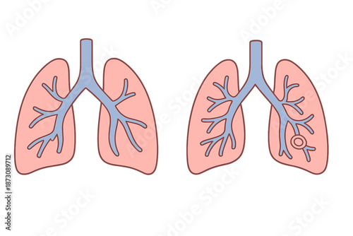 Visual representation of human lungs showing anatomy and branching airways with a main focus on airway structure and function