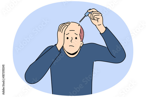 Man treats baldness with dropper of doctor-recommended healing oil that improves hair growth and makes him look attractive. Problem of baldness worries adult guy during midlife crisis