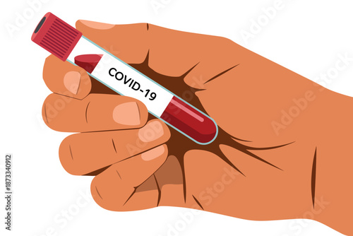 A hand holding a COVID-19 test tube with a red cap and liquid