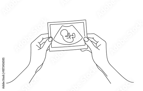 Linear drawing of hands holding ultrasound of baby