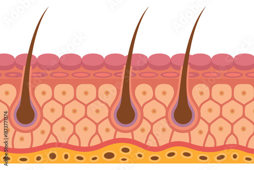 An illustration of the skin's layers with hair follicles and roots