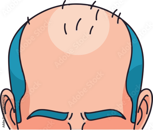 Close-up view of a person's head showing thinning hair and ears